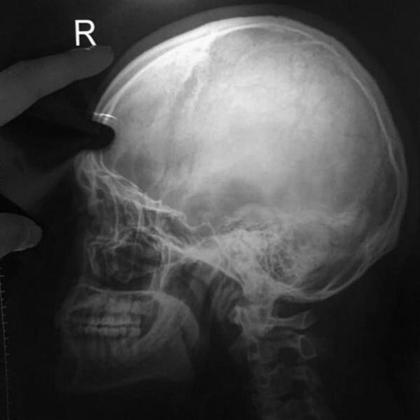 Hunger-Homme--Ice-Ratawit